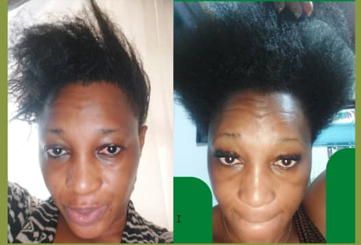 Before and after result 2