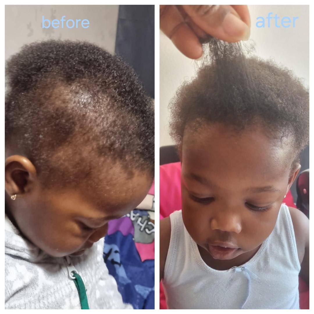 Before and after hair result